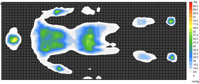 【フレアベル『サーモフェーズ アクティブモデル』体圧分布測定データ※】※被験者：30代男性（173 cm/70kg）測定条件：室温約23℃環境で仰臥姿勢をとり3分後に測定（枕不使用）