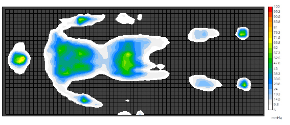 体圧分布測定データ